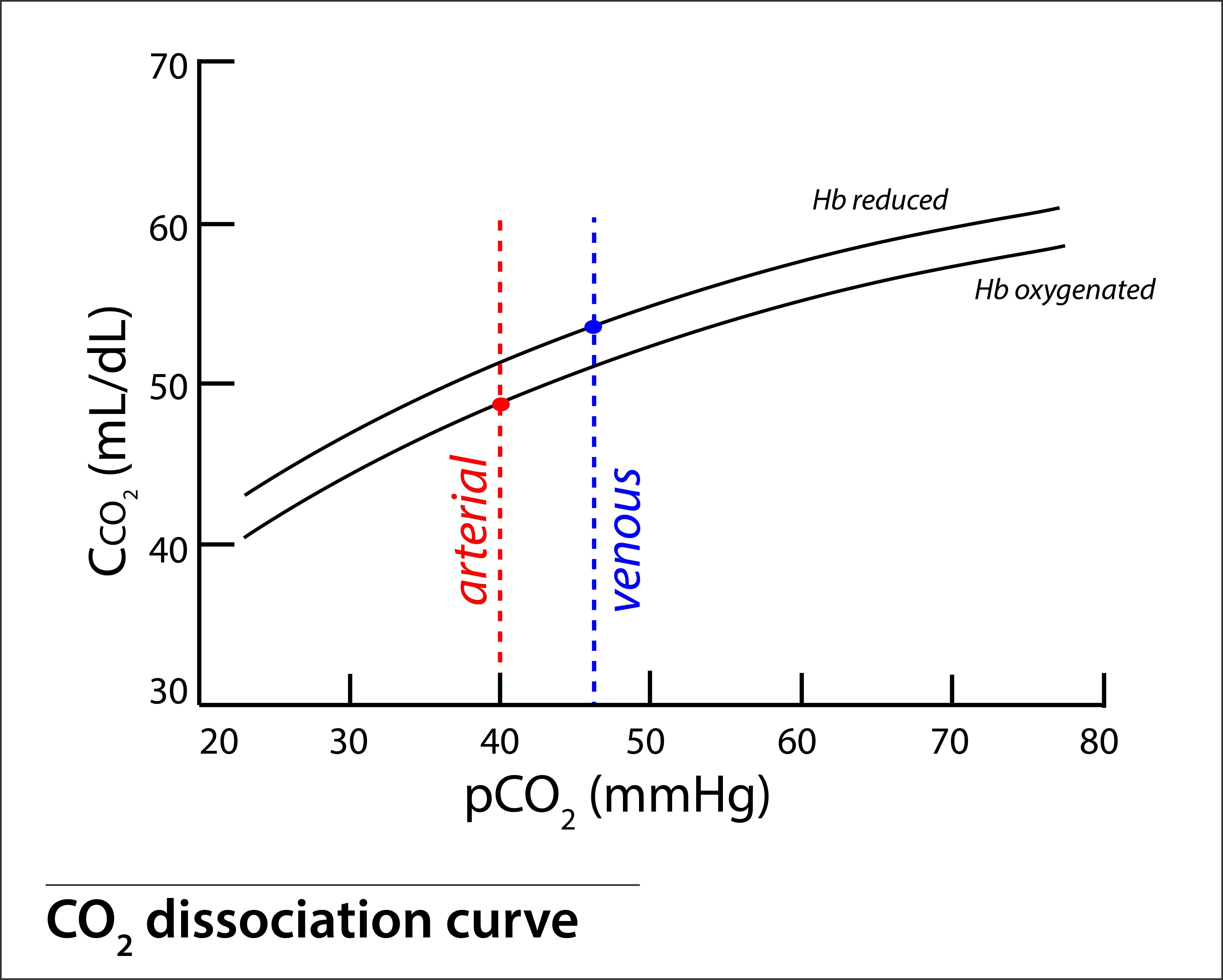 Acute Respiratory Failure Ecls Covid 19 Carbon Dioxide Removal